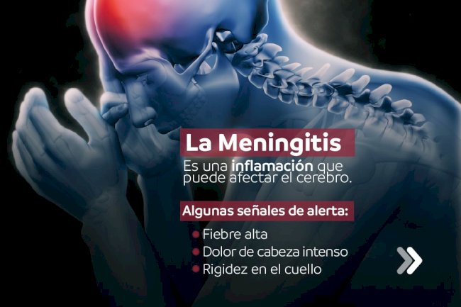 Meningitis: reconocer los síntomas puede salvar vidas